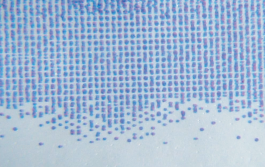 インテリジェントインターウィーブ